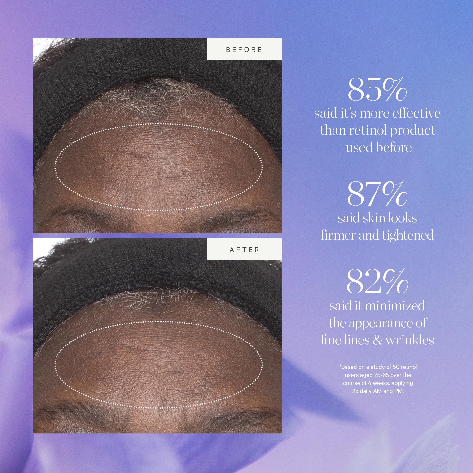 KORA Organics Plant Stem Cell Retinol Alternative Moisturizer – Hydrating & Firming Facial Cream
