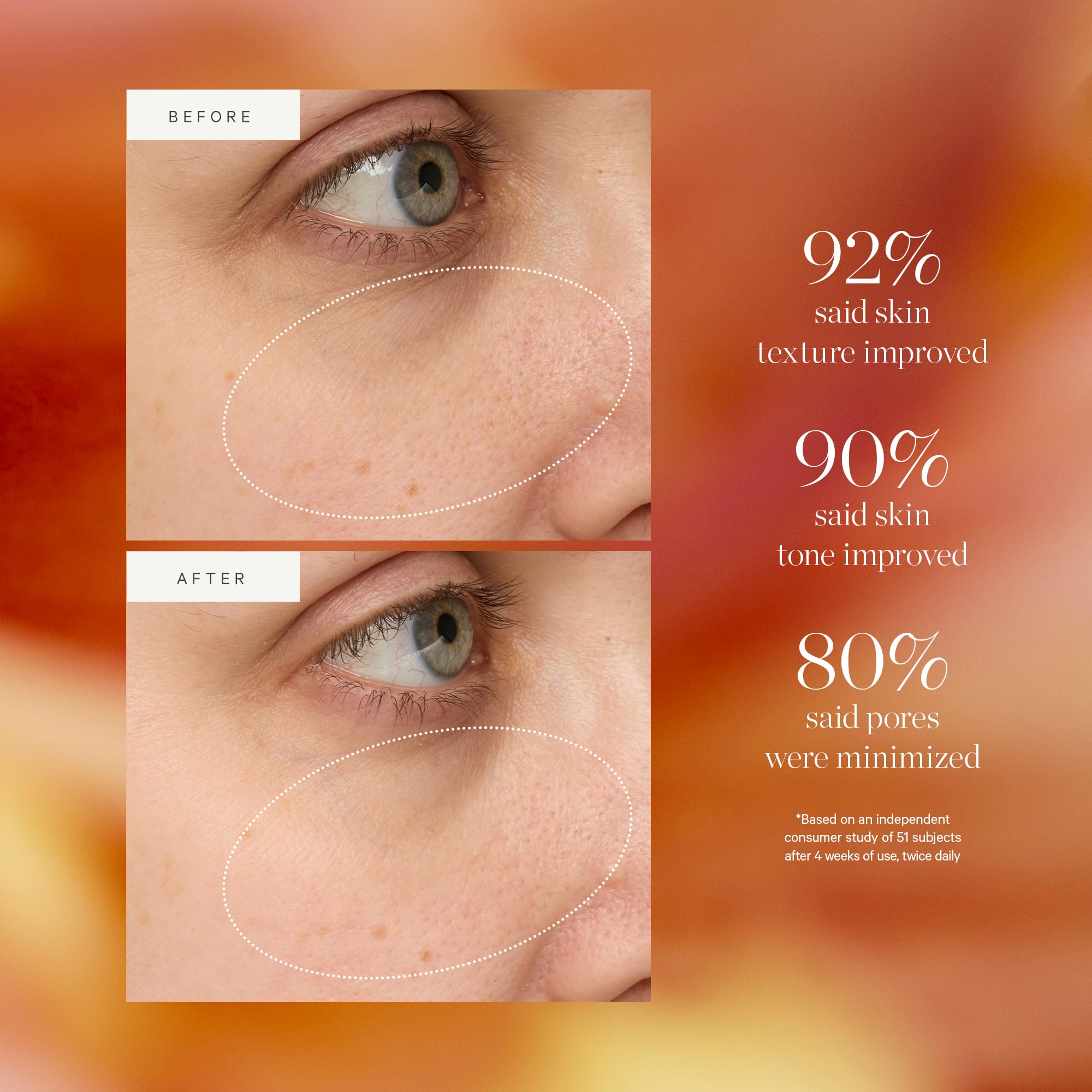 KORA Organics Turmeric Glow Drops – Organic Radiance Serum (Niacinamide Alternative)