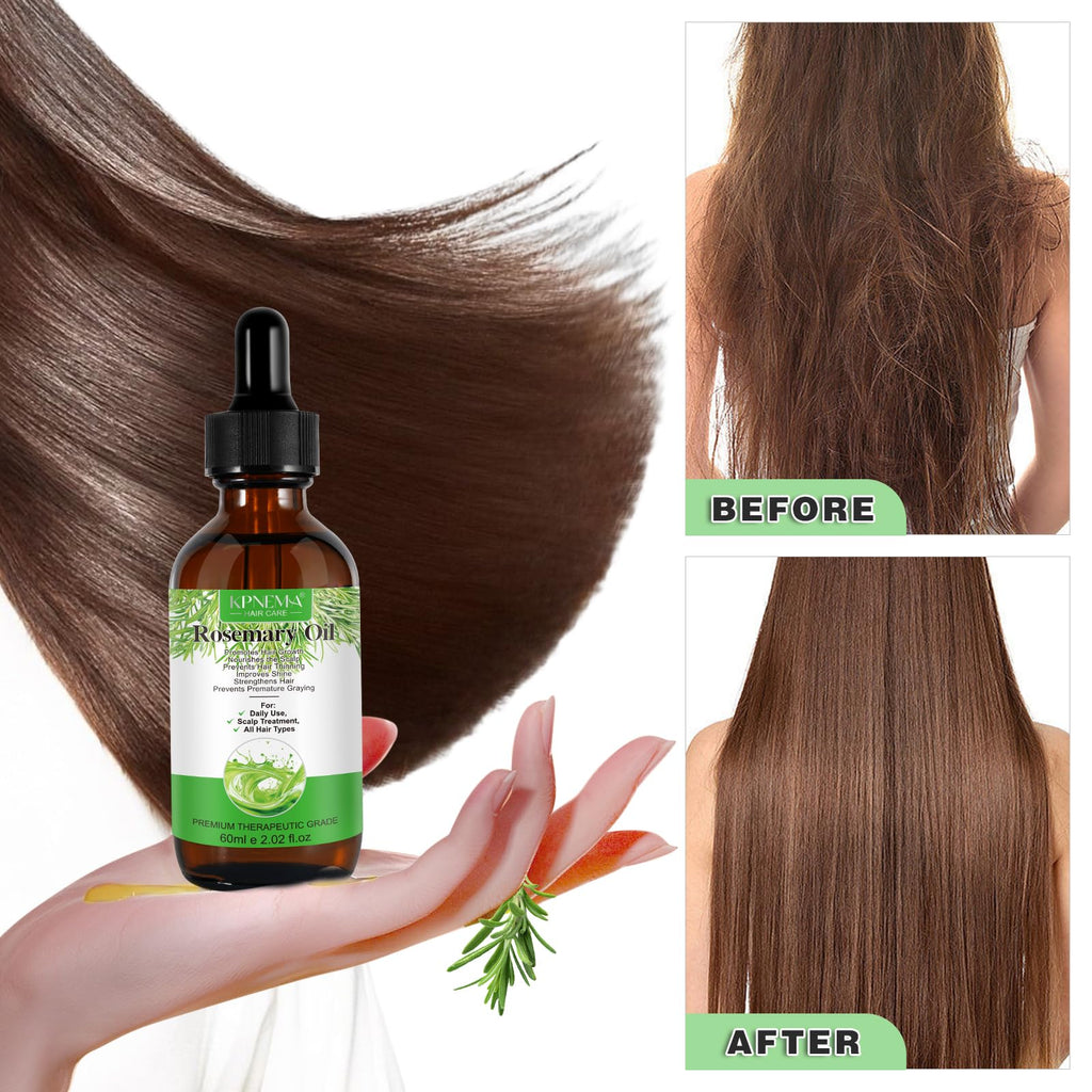 KPNEMA Rosemary Essential Oil – 100% Pure for Hair Growth & Nourished Skin (2.02 fl oz)