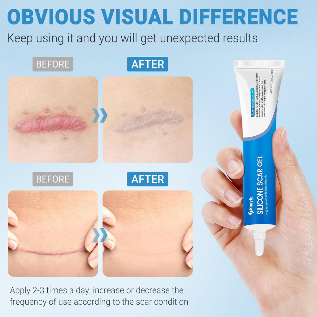 Kunyle Silicone Scar Gel - Advanced Scar Cream for Surgical Scars & Stretch Marks | 0.63oz