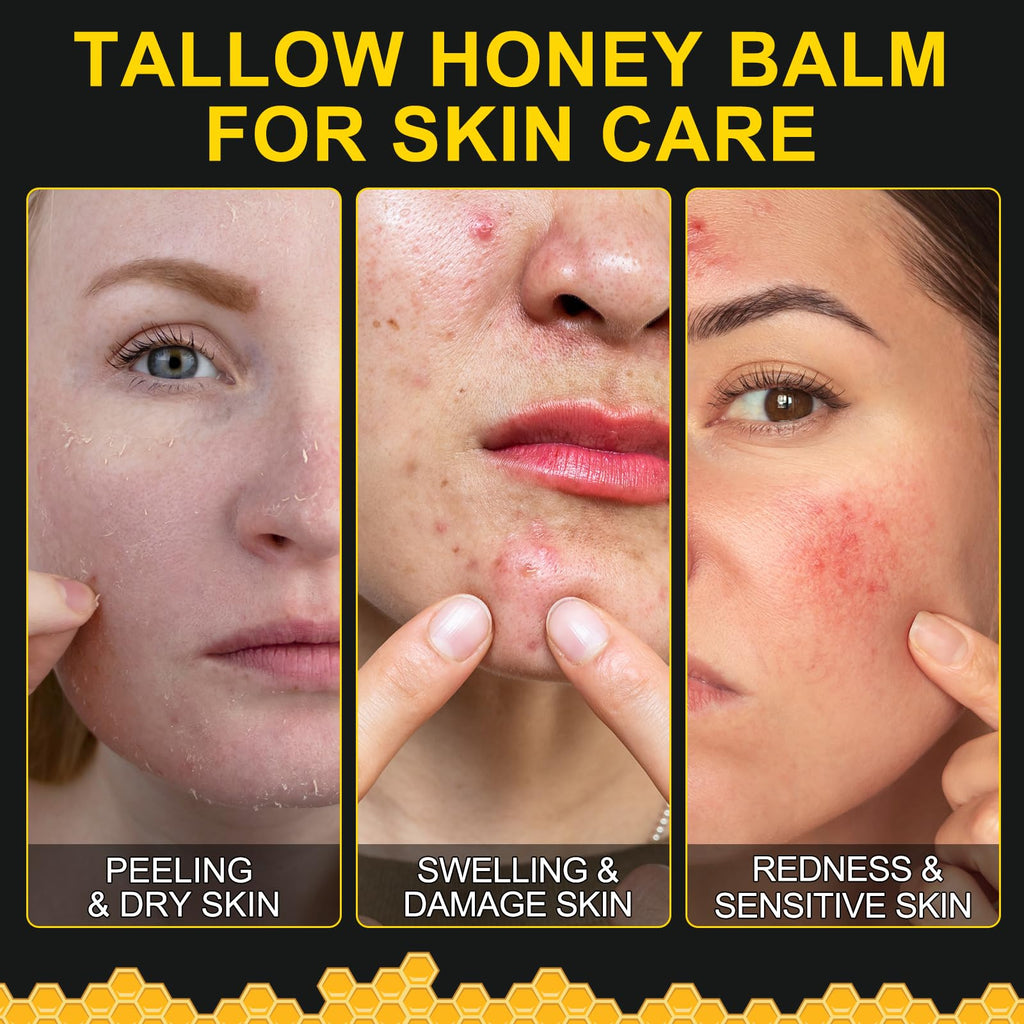 KZUO Beef Tallow Moisturizer — Whipped Balm with Raw Honey & Beeswax