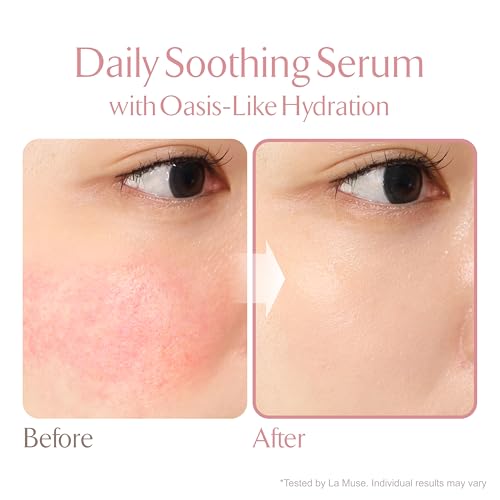 LA MUSE Oasis Soothing Serum Tube – Deep Hydration, Instant Cooling, Non-Sticky Gel