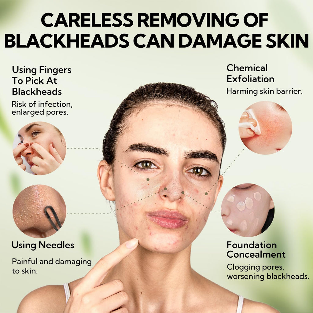 LANBENA Upgraded 2.0 Bamboo Charcoal Blackhead Remover Mask – 60 Nose Strips