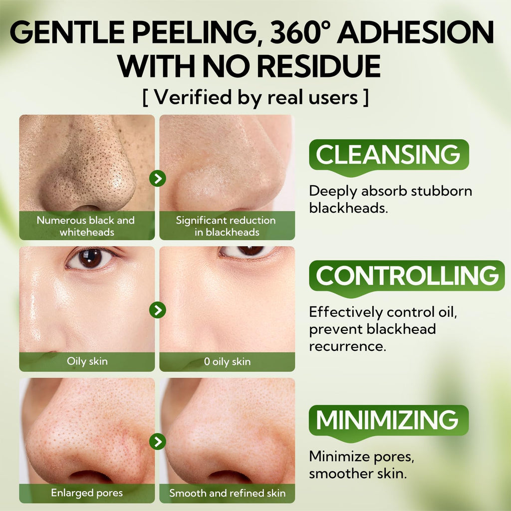 LANBENA Upgraded 2.0 Bamboo Charcoal Blackhead Remover Mask – 60 Nose Strips