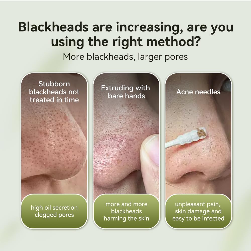 LANBENA Blackhead Mask & Nose Pore Strips — Purifying Peel-Off Mask (1.06 oz)