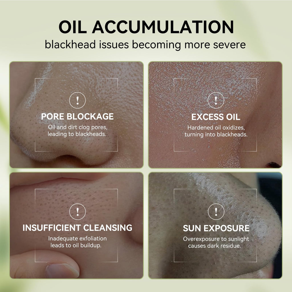 LANBENA 3-in-1 Blackhead Removal Set — Bamboo Charcoal Pore Strips, Pore Minimizing Serum & Removal Papers