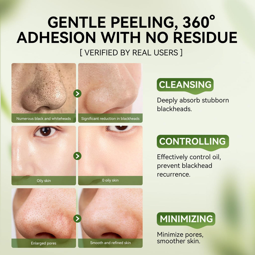 LANBENA 3-in-1 Blackhead Removal Set — Bamboo Charcoal Pore Strips, Pore Minimizing Serum & Removal Papers