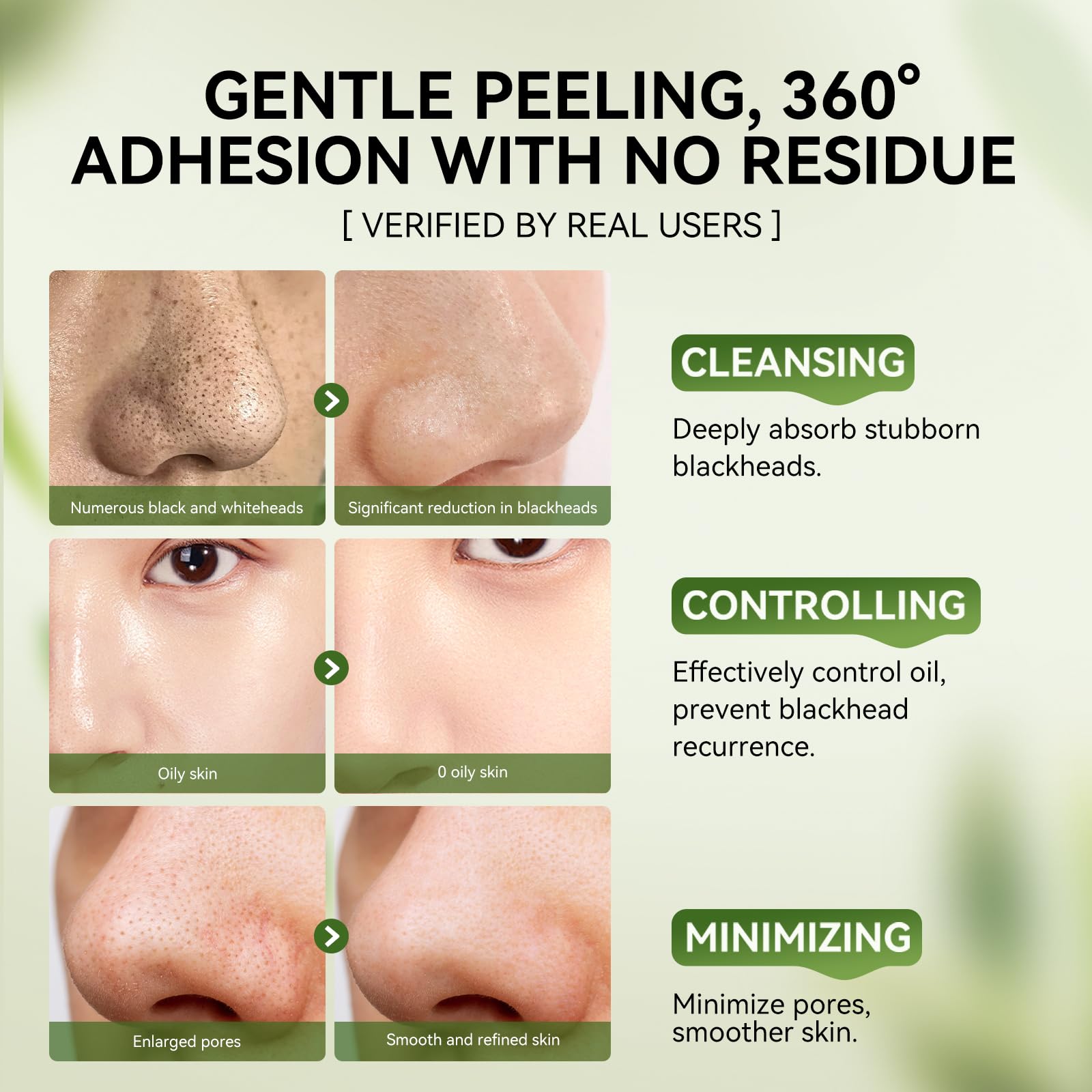 LANBENA 3-in-1 Blackhead Removal Set — Bamboo Charcoal Pore Strips, Pore Minimizing Serum & Removal Papers