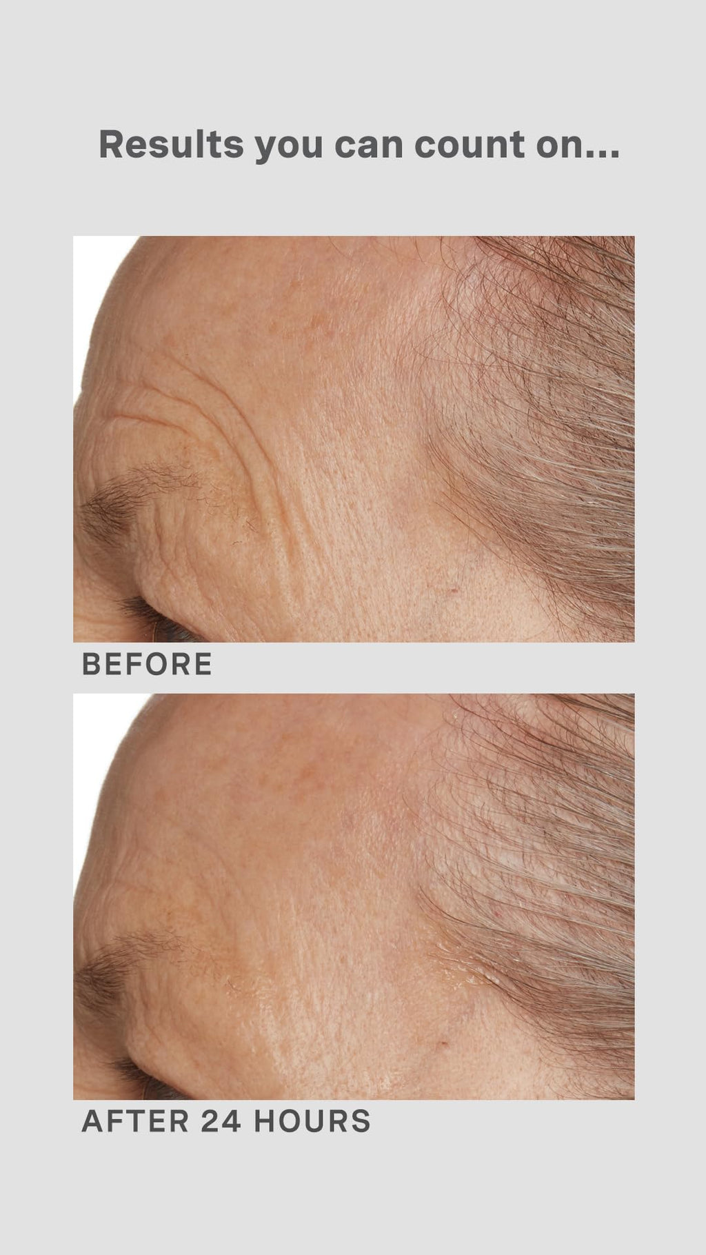 Lancer Gravity Defying Moisturizer with Firming Technology – Hydration, Elasticity & Anti-Aging
