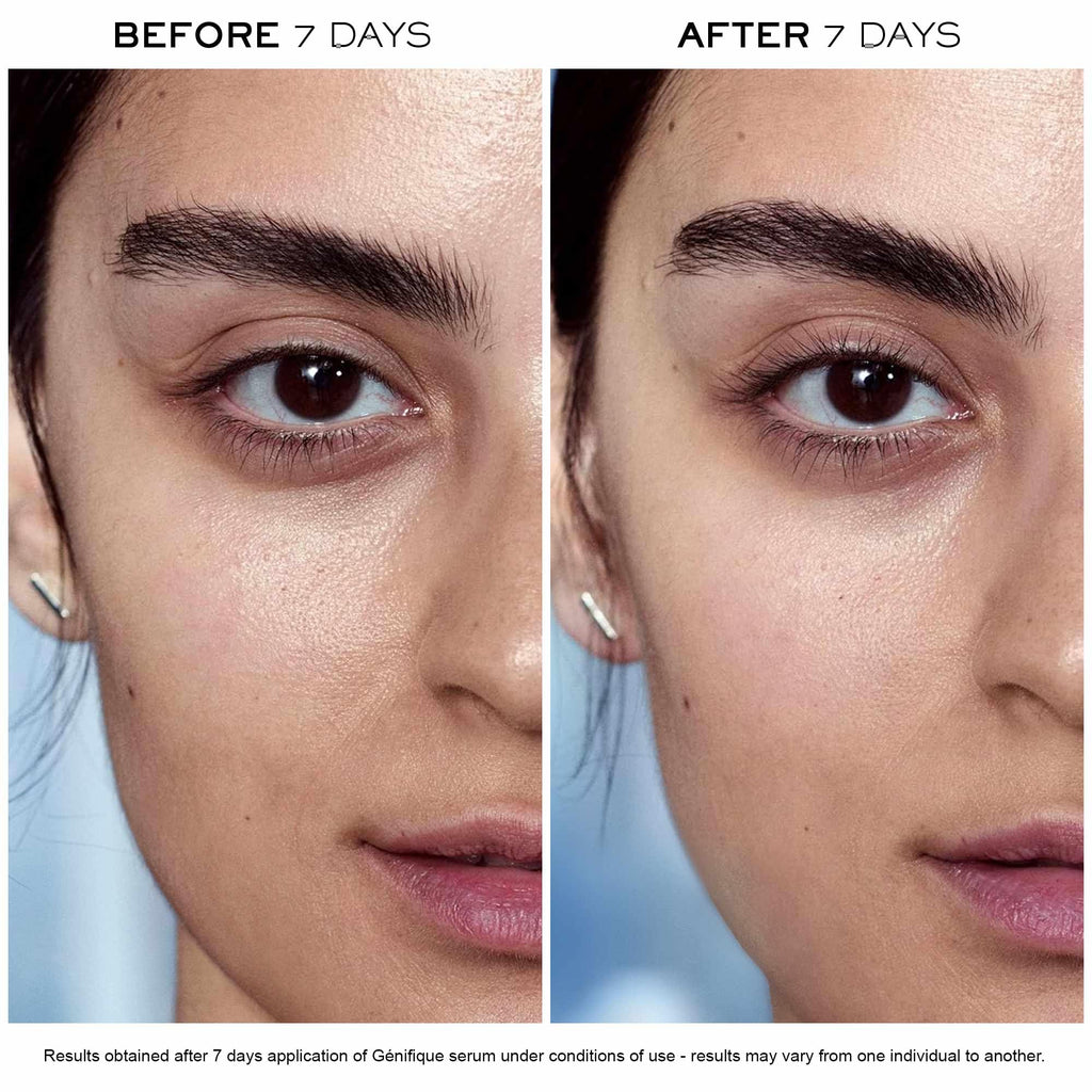 Lancôme Advanced Génifique Radiance Boosting Serum – Hydration, Elasticity & Glow | 1 Fl Oz