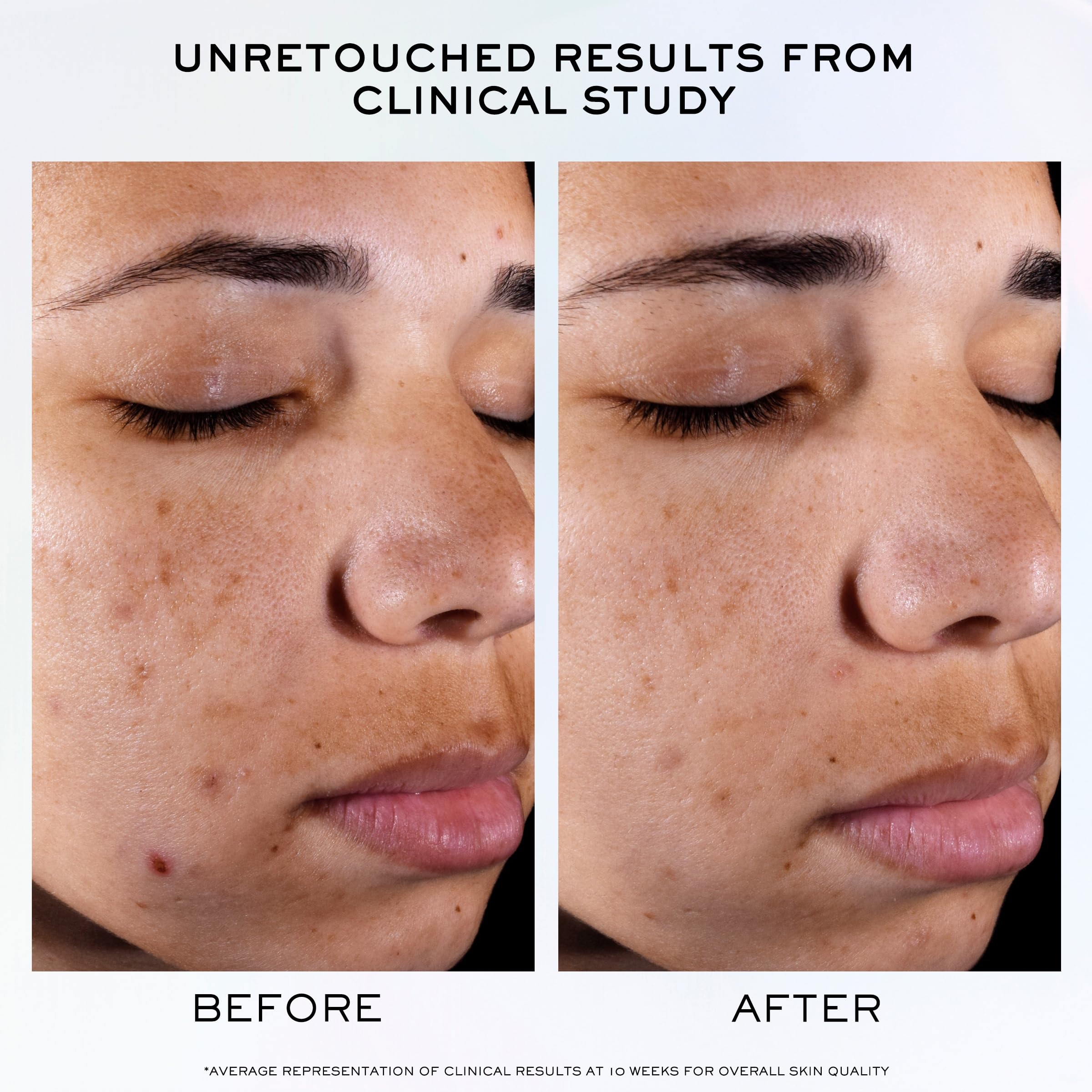 Lancôme Clarifique Pro-Solution Serum – 10% PHA + Niacinamide | Dark Spot & Post-Acne Brightening | 1.7 Fl Oz
