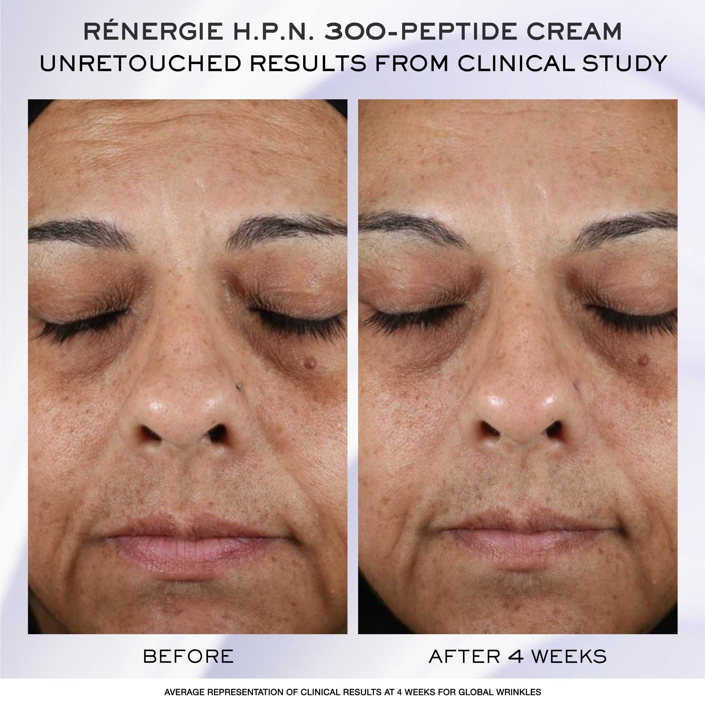 Lancôme Rénergie H.C.F. Triple Serum Discovery Set – Full-Size Serum + Mini Cream & Eye Cream
