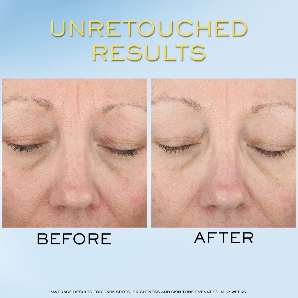 Lancôme Supra Screen Invisible Serum Sunscreen SPF 50+ – Anti-Aging Protection & Hydration