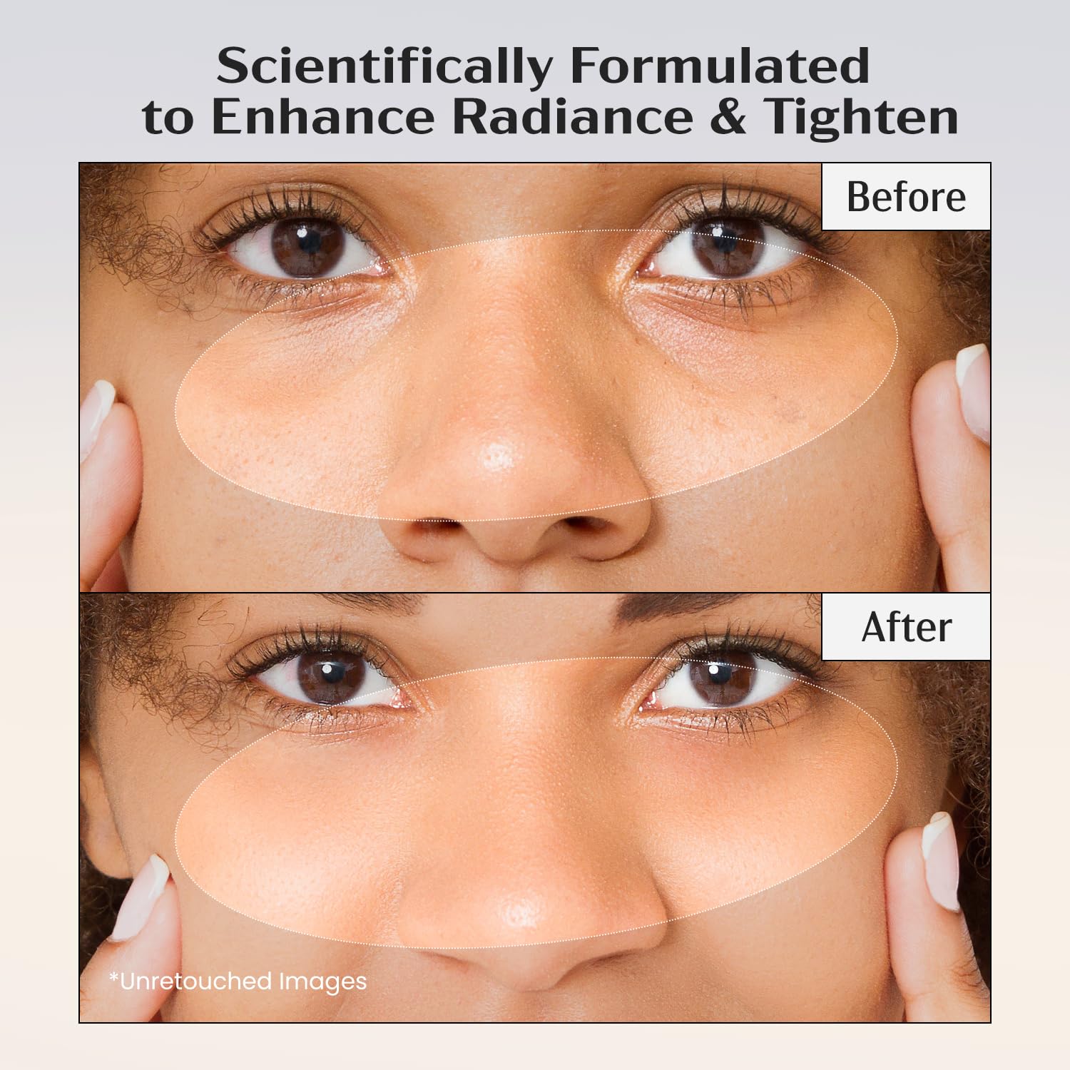 Lanmeri Ceuticals Vitamin C Serum 15% + E 1% + Ferulic 0.5% — Pack of 2 (1 oz each)