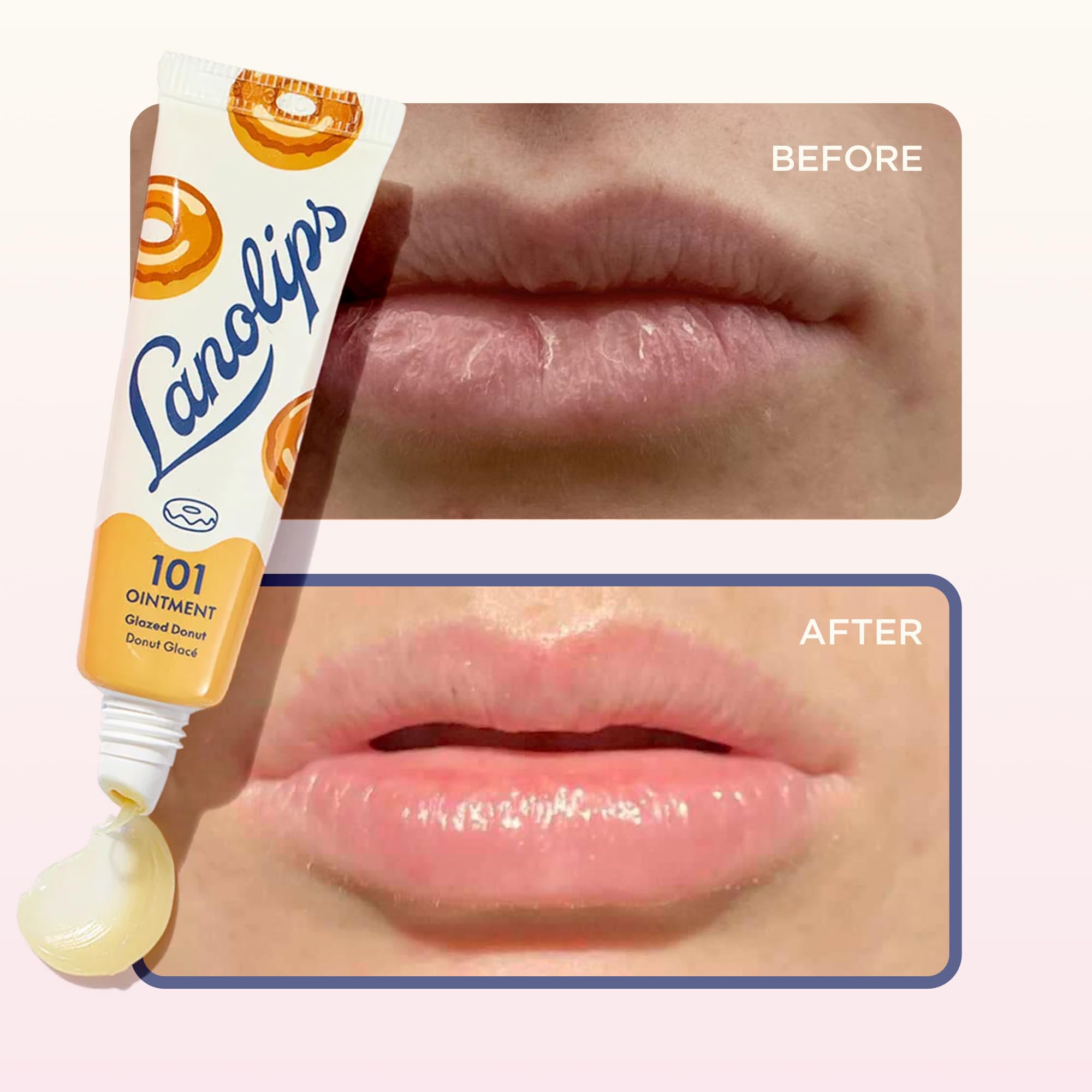 Lanolips 101 Ointment – Glazed Donut Lip Balm for Hydration & Multipurpose Care (0.52 oz)