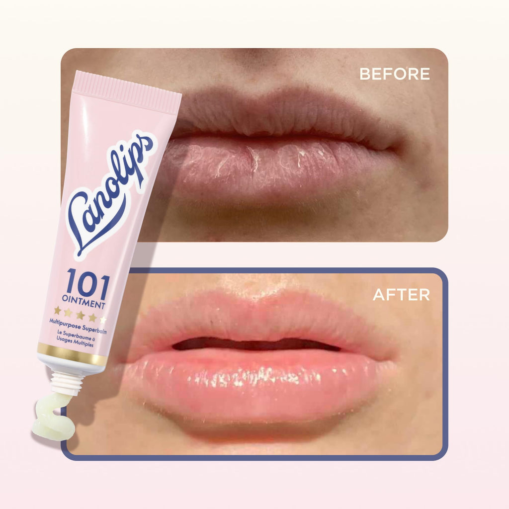 Lanolips 101 Ointment Multi-Balm Duo, Original Superbalm – Pure Lanolin Lip & Skin Care (2-Pack, 0.52 oz each)