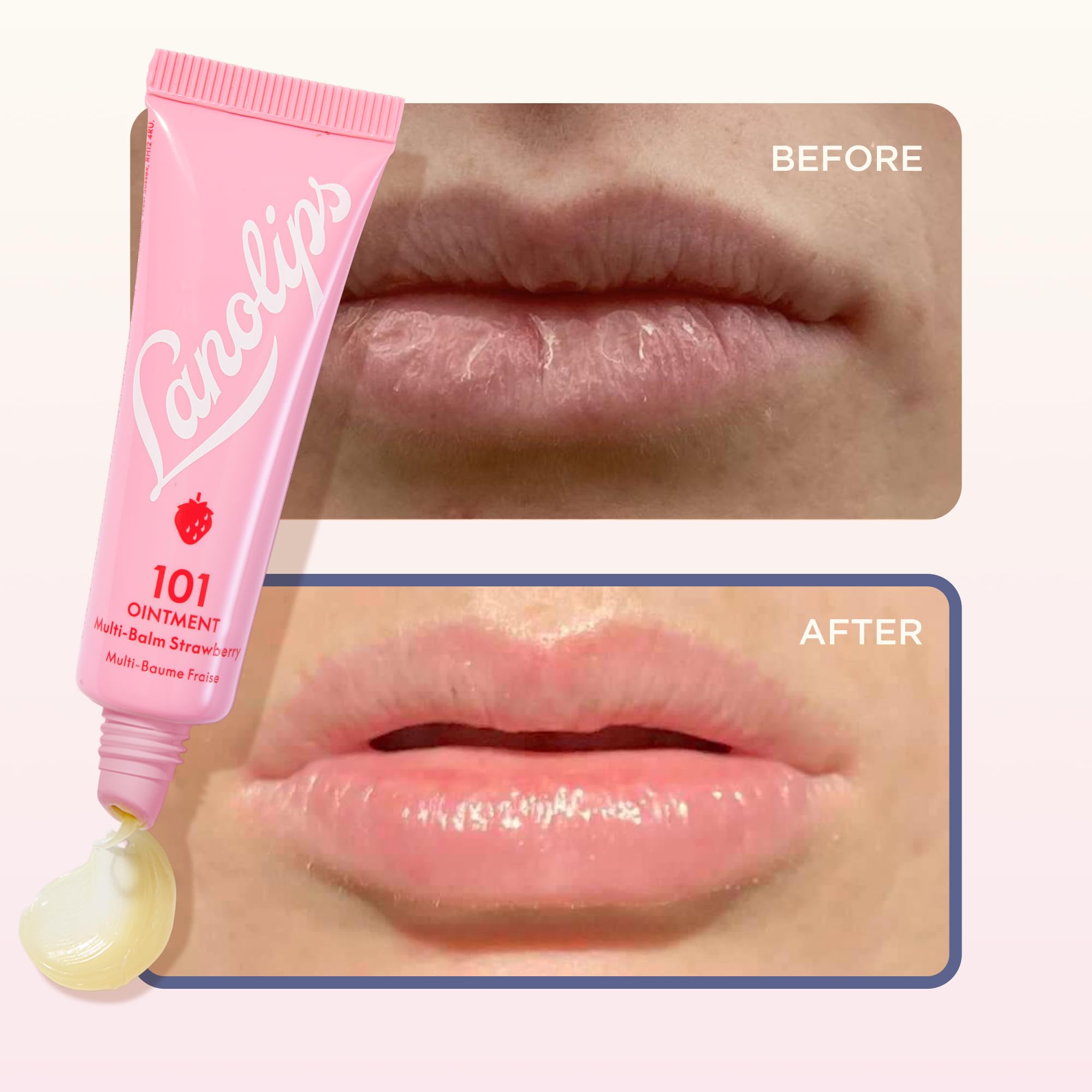 Lanolips 101 Ointment Strawberry Lip Balm 0.52 oz – Hydration for Lips & More