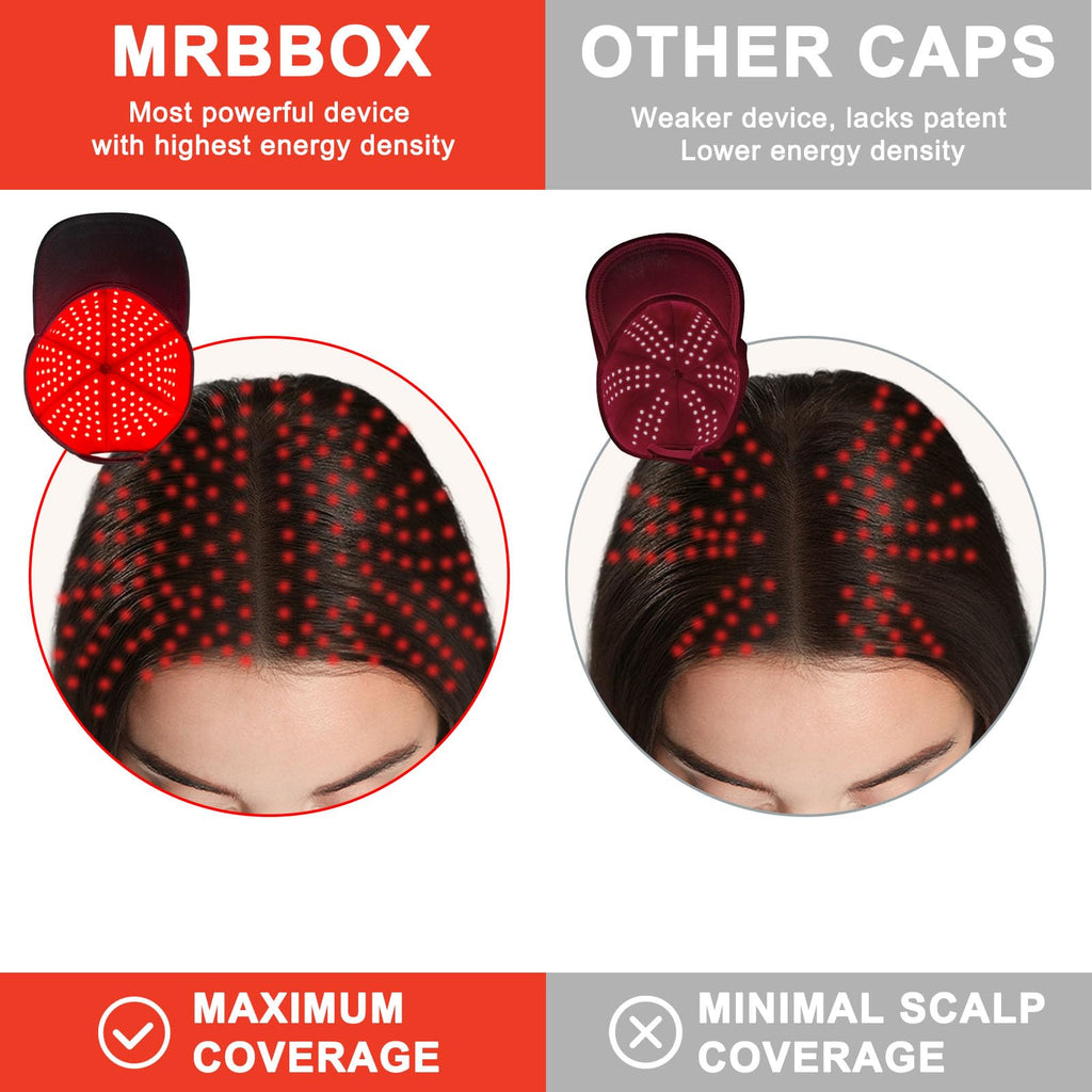 Laser Hair Growth Cap — Non-Invasive Red & Infrared Light Therapy for Scalp