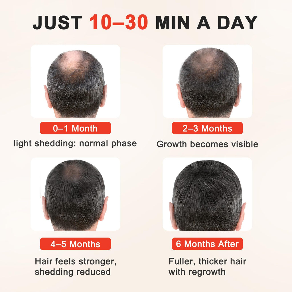 Laser Hair Growth Cap — Non-Invasive Red & Infrared Light Therapy for Scalp