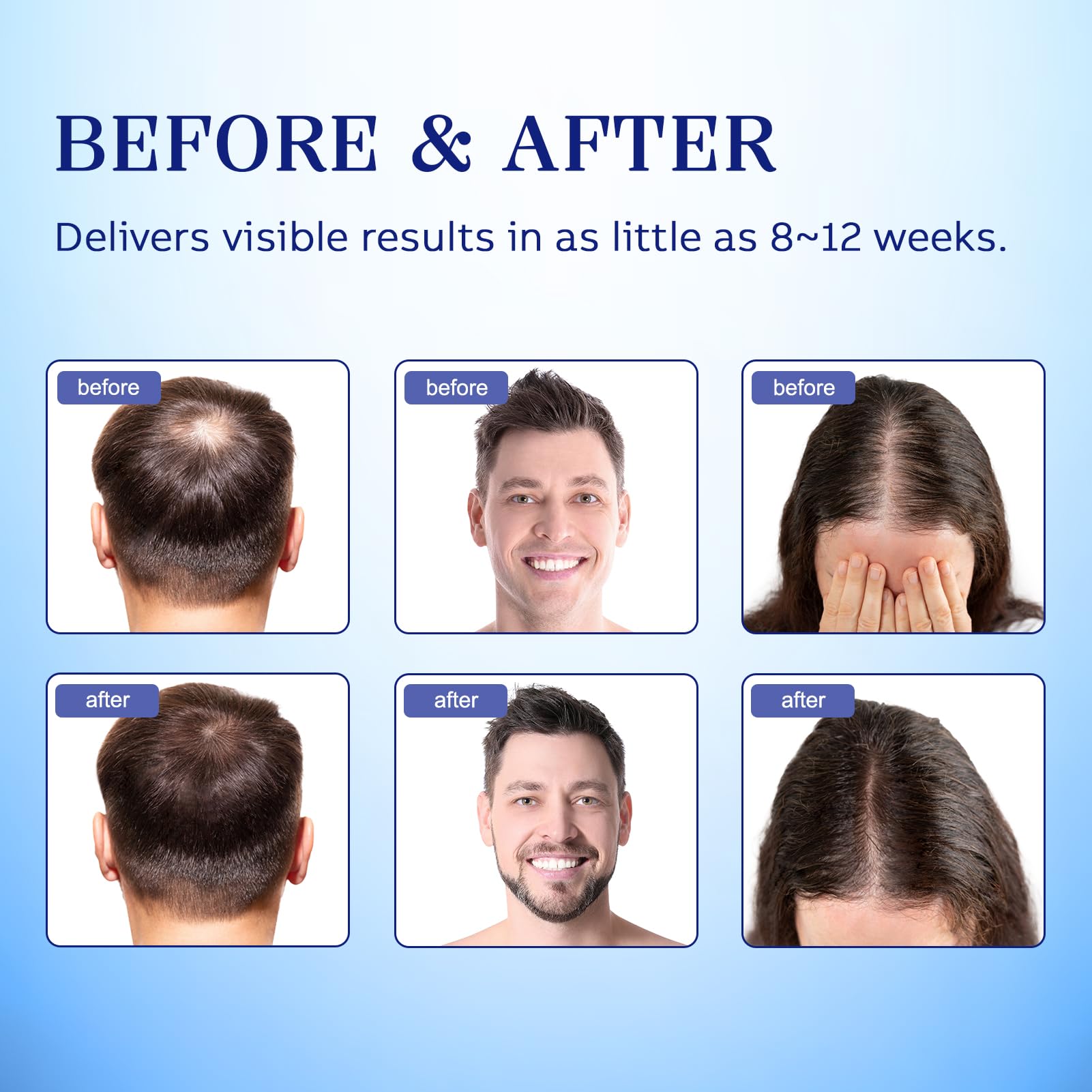 Lavtek 5% Minoxidil for Men & Women – Hair Growth Spray 2-Pack