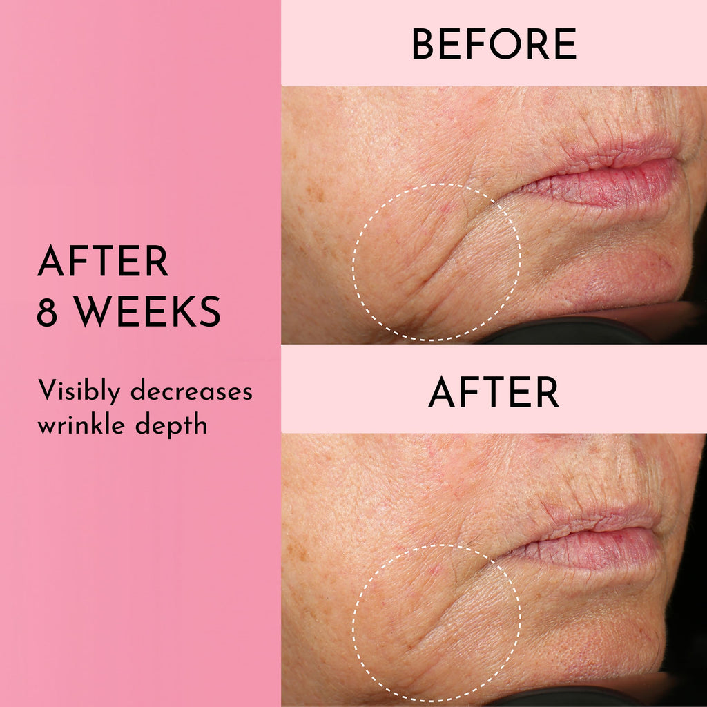 Lawless Forget the Filler Skin-Plumping Cream | Prime, Plump & Smooth | 1.7 oz