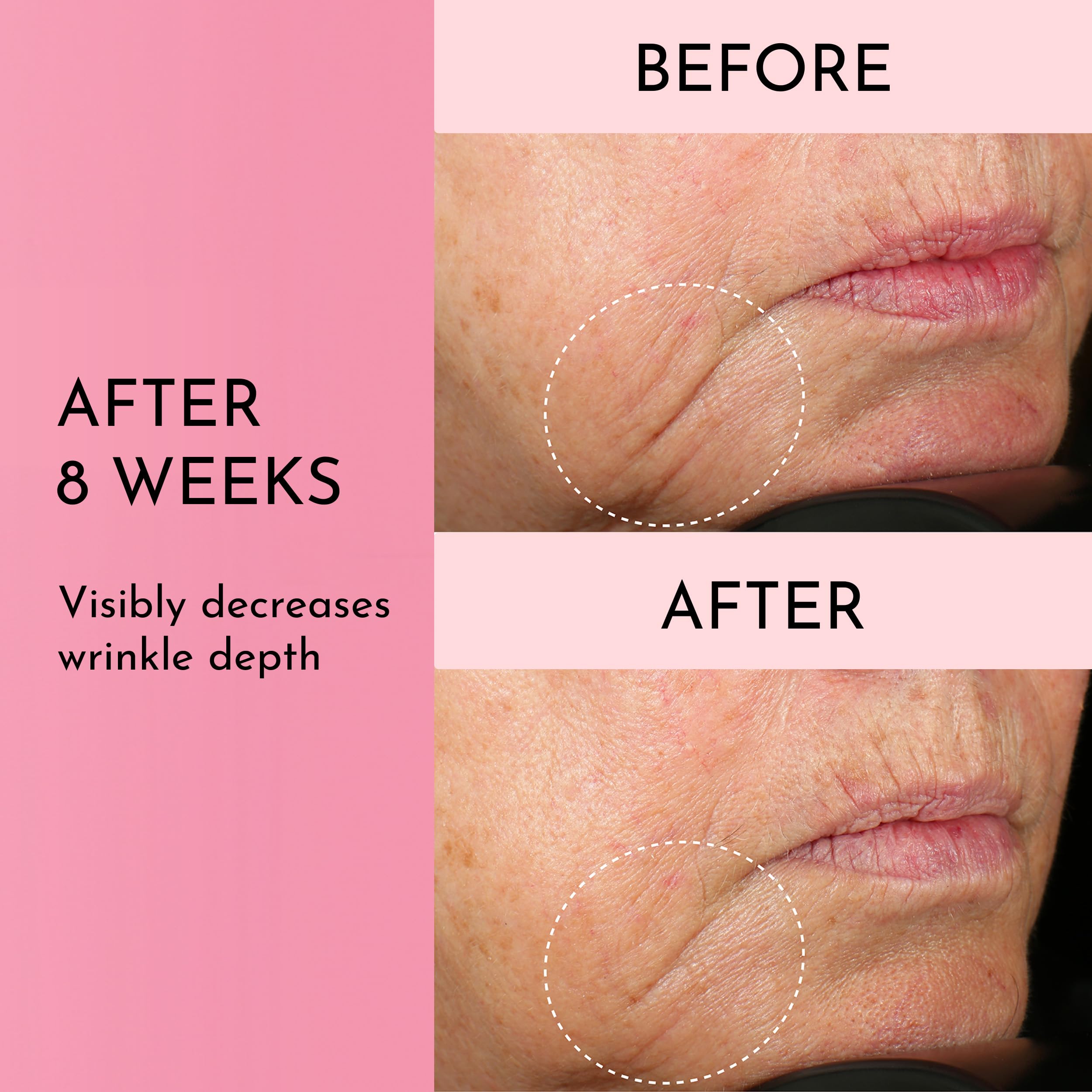 Lawless Forget the Filler Skin-Plumping Cream | Prime, Plump & Smooth | 1.7 oz