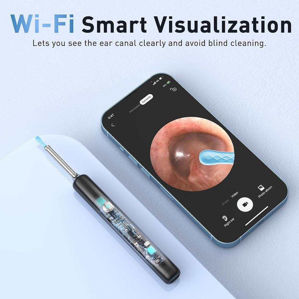 Lebbtl Ear Wax Removal System with 1080P Camera, 4 Modes, IPX5 Waterproof