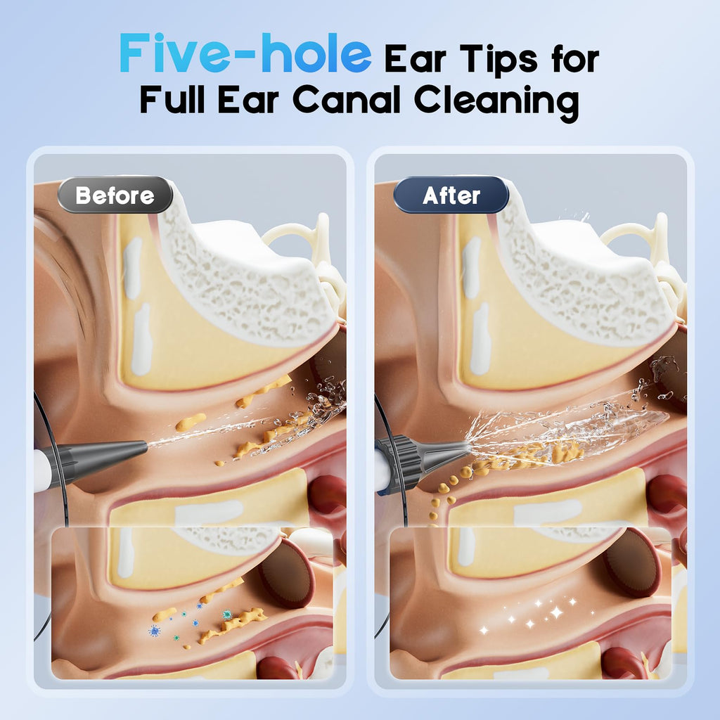 Lebbtl Ear Wax Removal Kit — 4 Modes, Digital Temperature Display, Safe Ear Irrigation System
