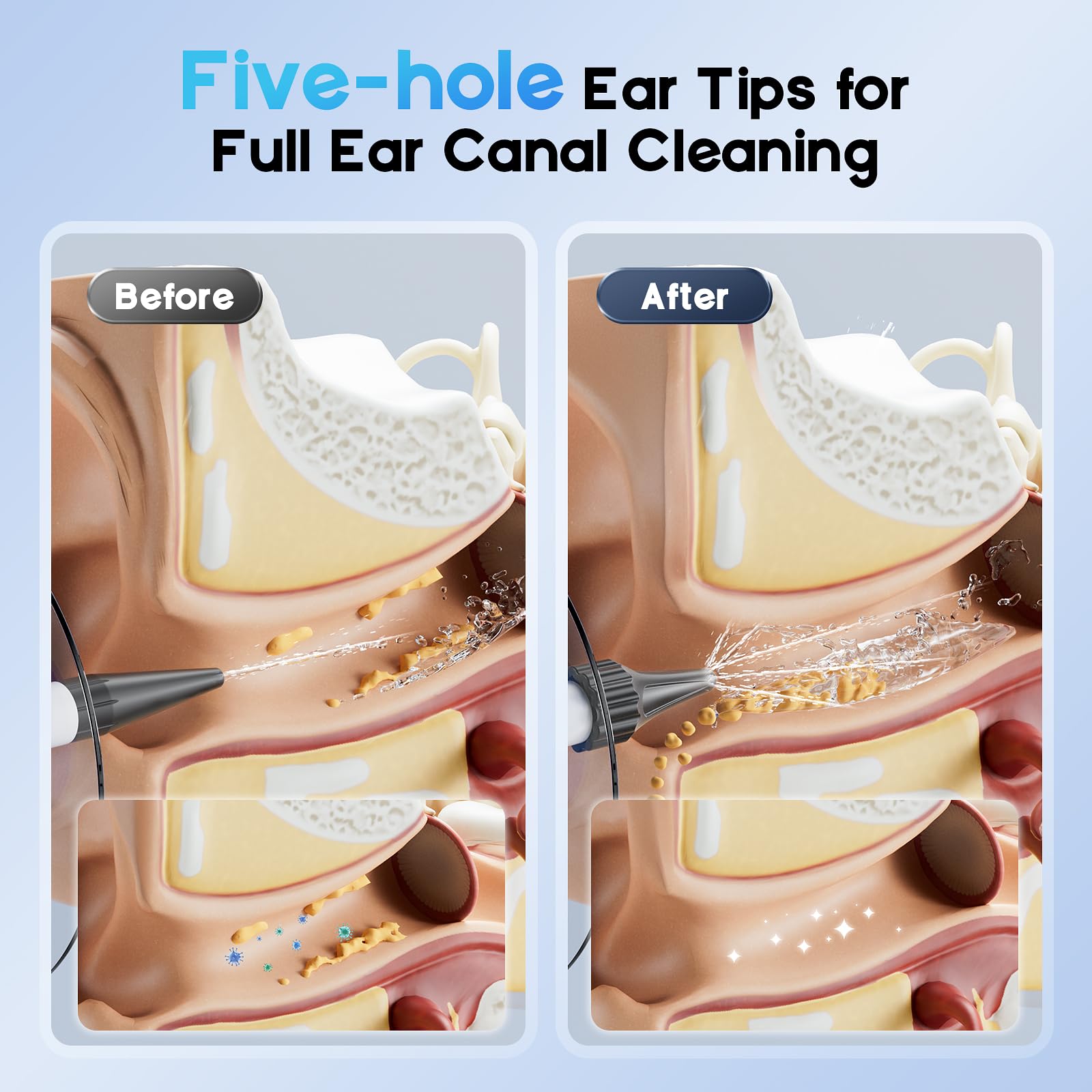 Lebbtl Ear Wax Removal Kit — 4 Modes, Digital Temperature Display, Safe Ear Irrigation System