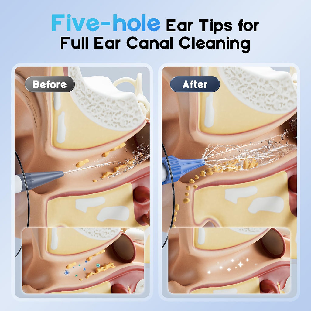 Lebbtl Ear Wax Removal Kit — Electric Ear Cleaning with Light, 4 Modes, Basin & 15 Tips