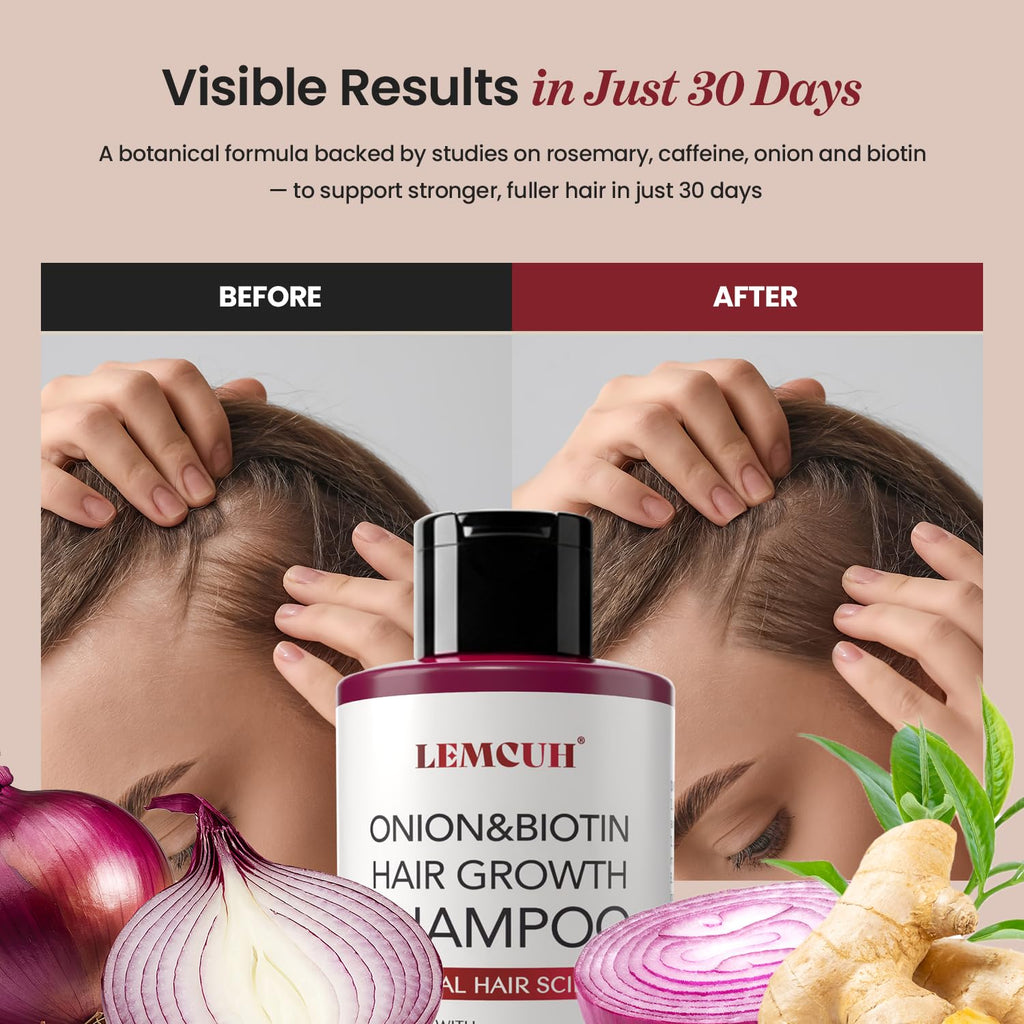 Lemcuh Rosemary Shampoo with Onion & Biotin – Volumizing Thickening Hair Care (12.5 oz)