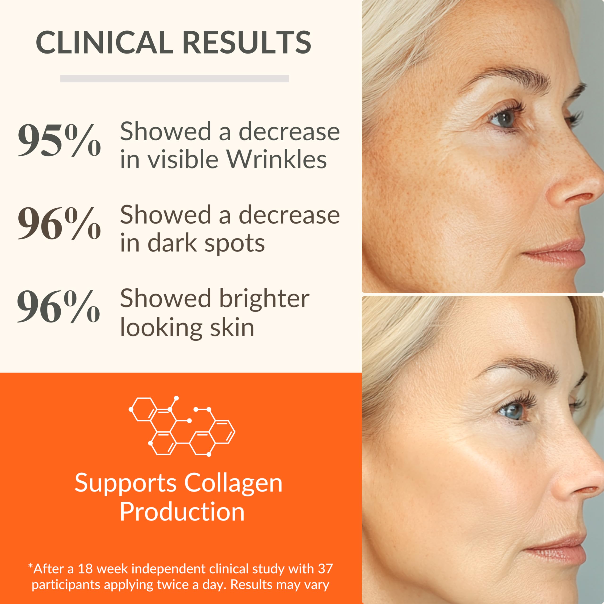 LeVaye Vitamin C Serum – 15% Vitamin C with Ferulic Acid, Niacinamide & Hyaluronic Acid