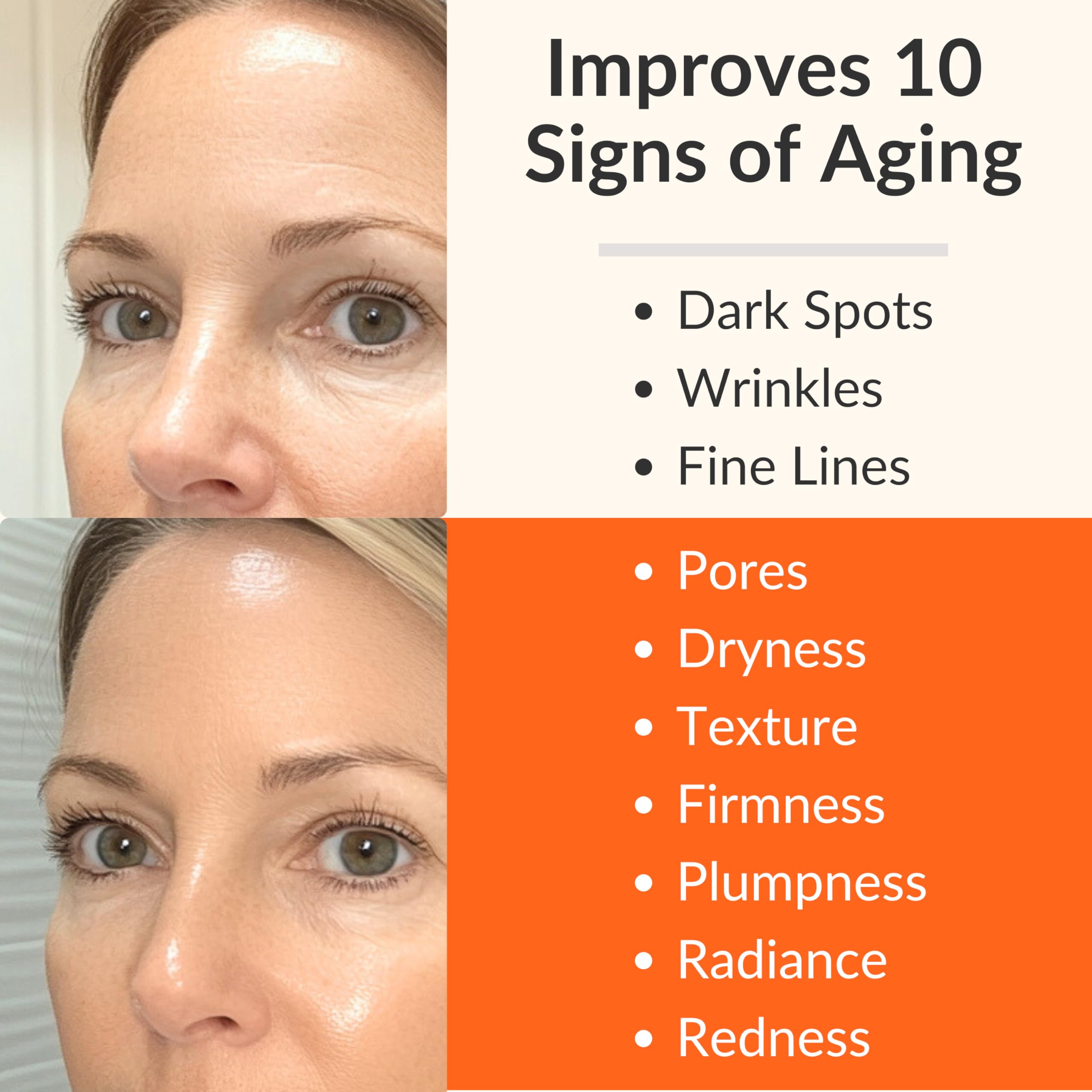 LeVaye Vitamin C Serum – 15% Vitamin C with Ferulic Acid, Niacinamide & Hyaluronic Acid