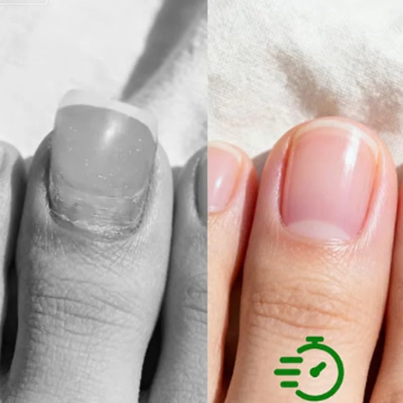 LEWELLRY 2PCS Nail Care – Fast-Drying Nail Repair Serum, 11ml, Cuticle & Nail Strength