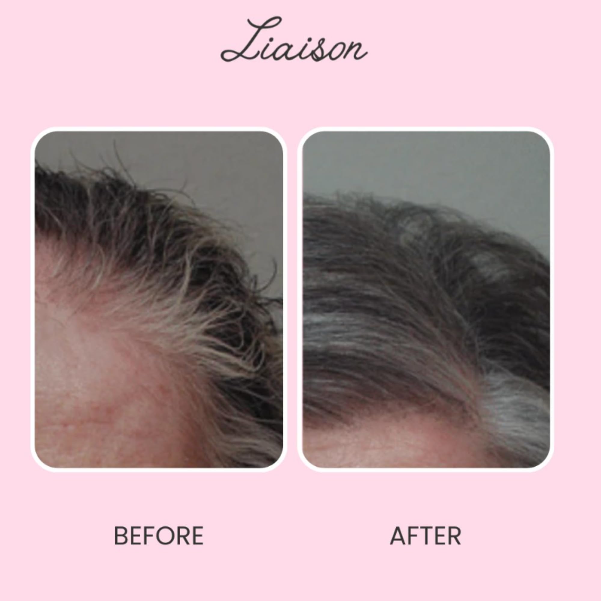 Liaison Gray Repair Hair Serum – Restore Color & Shine with Ginger & Angelica (15ml)