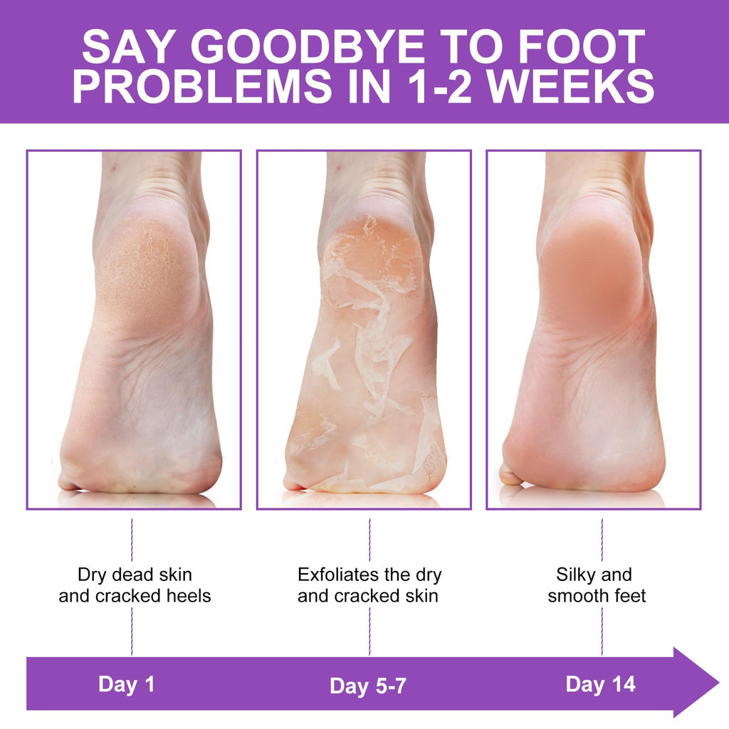 Liefiet Lavender Foot Peeling Mask 5 Pack – Exfoliate, Hydrate, Soft Feet