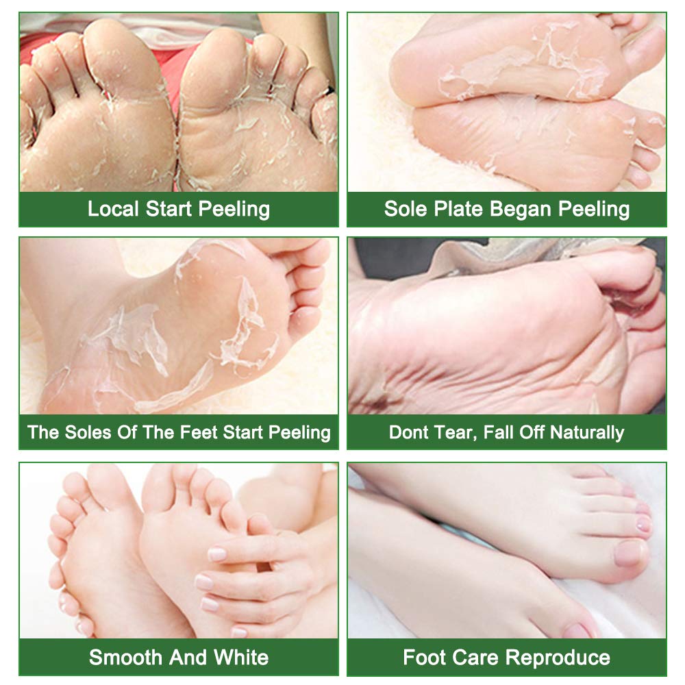 Liefiet Foot Peeling Mask 5 Pack – Lavender-Infused Exfoliating Socks for Soft Feet