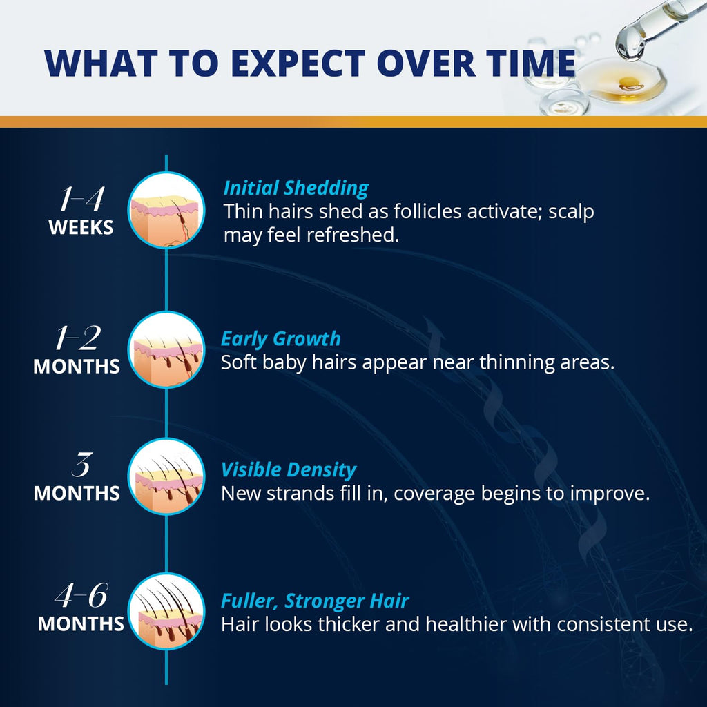 Lilivera 5% Minoxidil Hair & Beard Growth Kit – Extra Strength Topical Serum