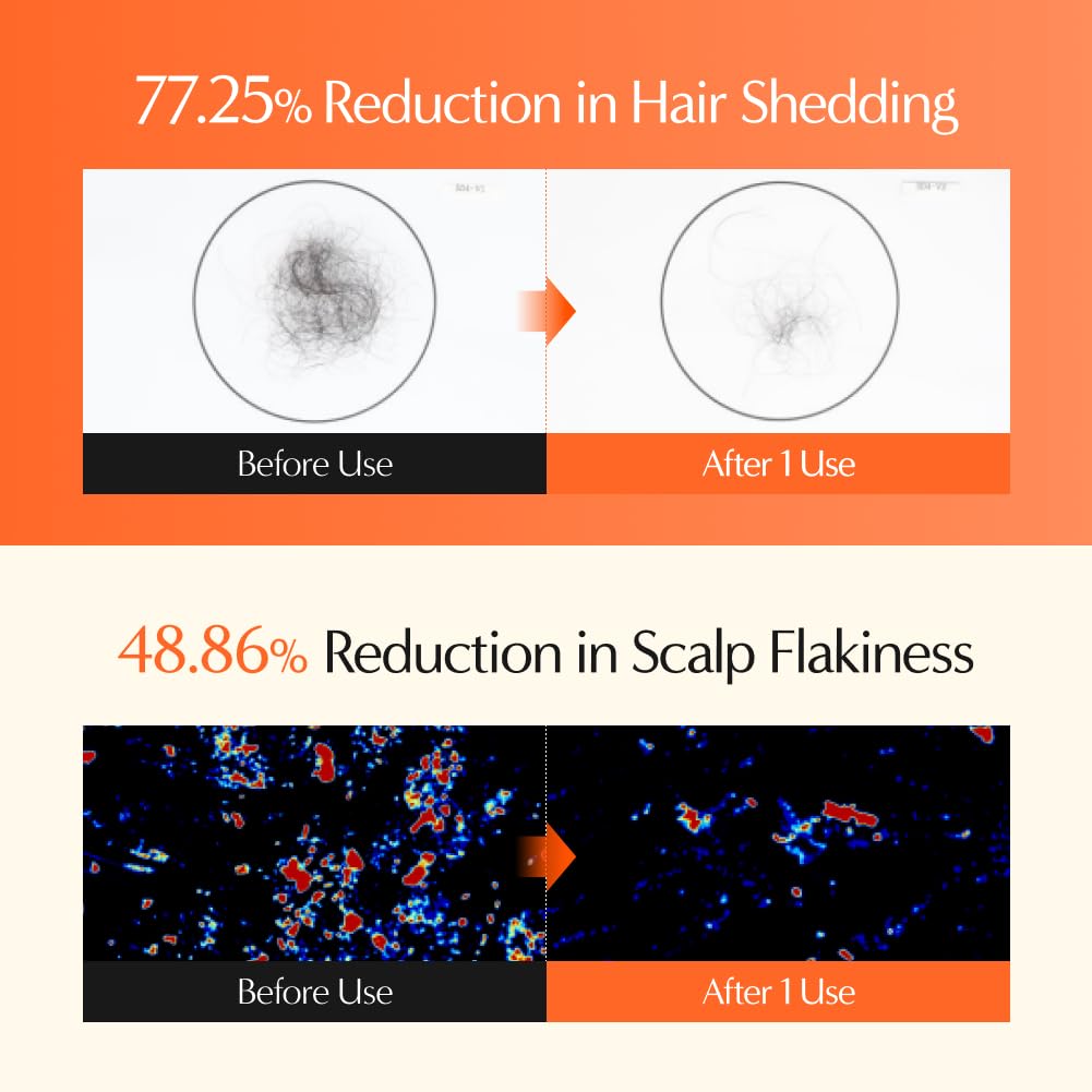 lilyeve GrowTurn 3D Volume Shampoo with Built-In Brush | Fuller-Looking Hair & Gentle Scalp Care | 6.76 Fl Oz