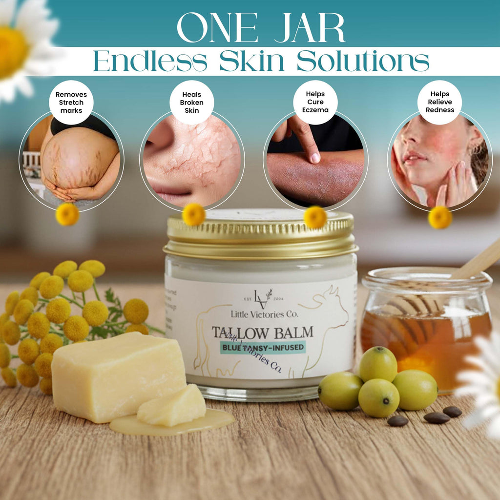 Little Victories Co. 2.0 fl oz Beef Tallow Honey Balm with Blue Tansy – All‑Over Skin Moisturizer