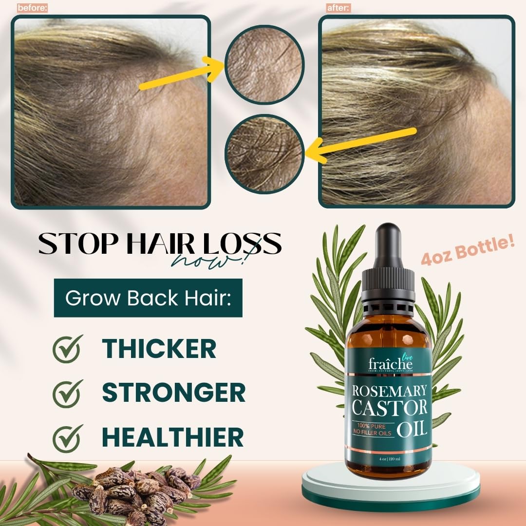 Live Fraiche Rosemary Castor Oil for Hair Growth – 4 oz, Cold-Pressed, No Fillers