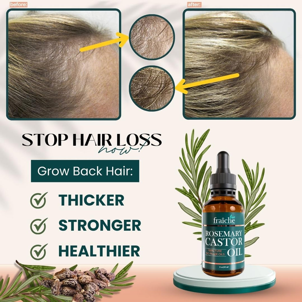 Live Fraiche Rosemary Oil for Hair Growth – 2oz with Cold-Pressed Castor Oil