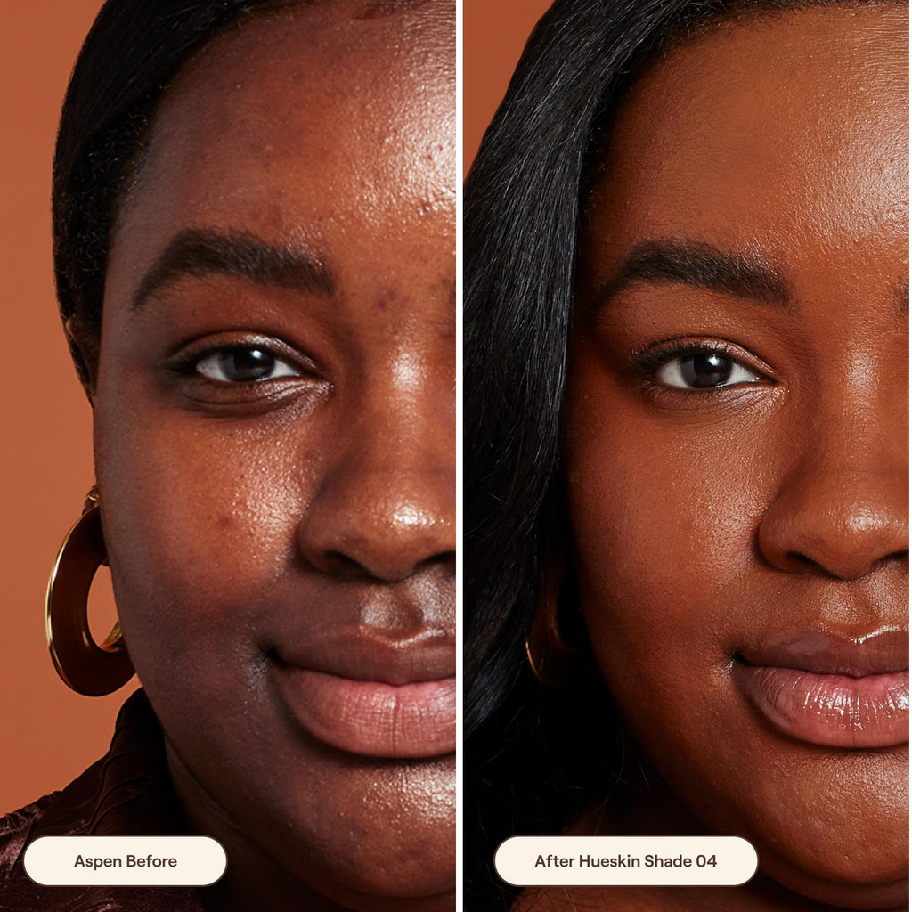 Live Tinted Hueskin Serum Concealer - Medium-to-Full Coverage, Niacinamide + Hyaluronic Acid, Shade 4