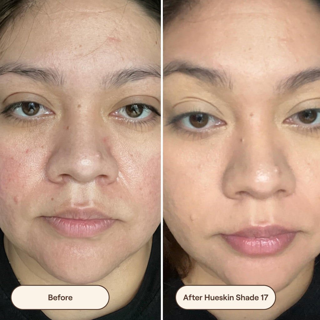 Live Tinted Hueskin Serum Concealer - Medium-to-Full Coverage with Niacinamide & Hyaluronic Acid, Shade 17