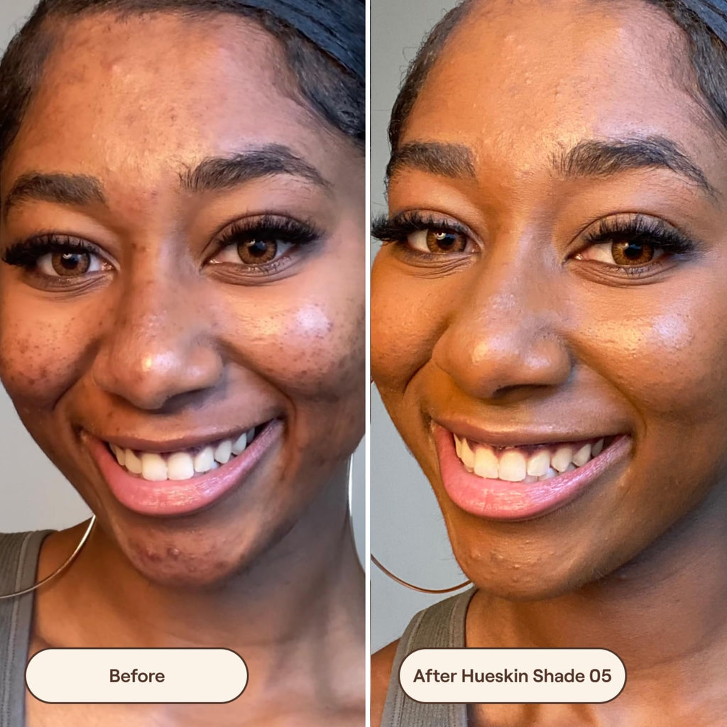 Live Tinted Hueskin Serum Concealer – Medium-to-Full Coverage with Niacinamide & Hyaluronic Acid, Shade 5