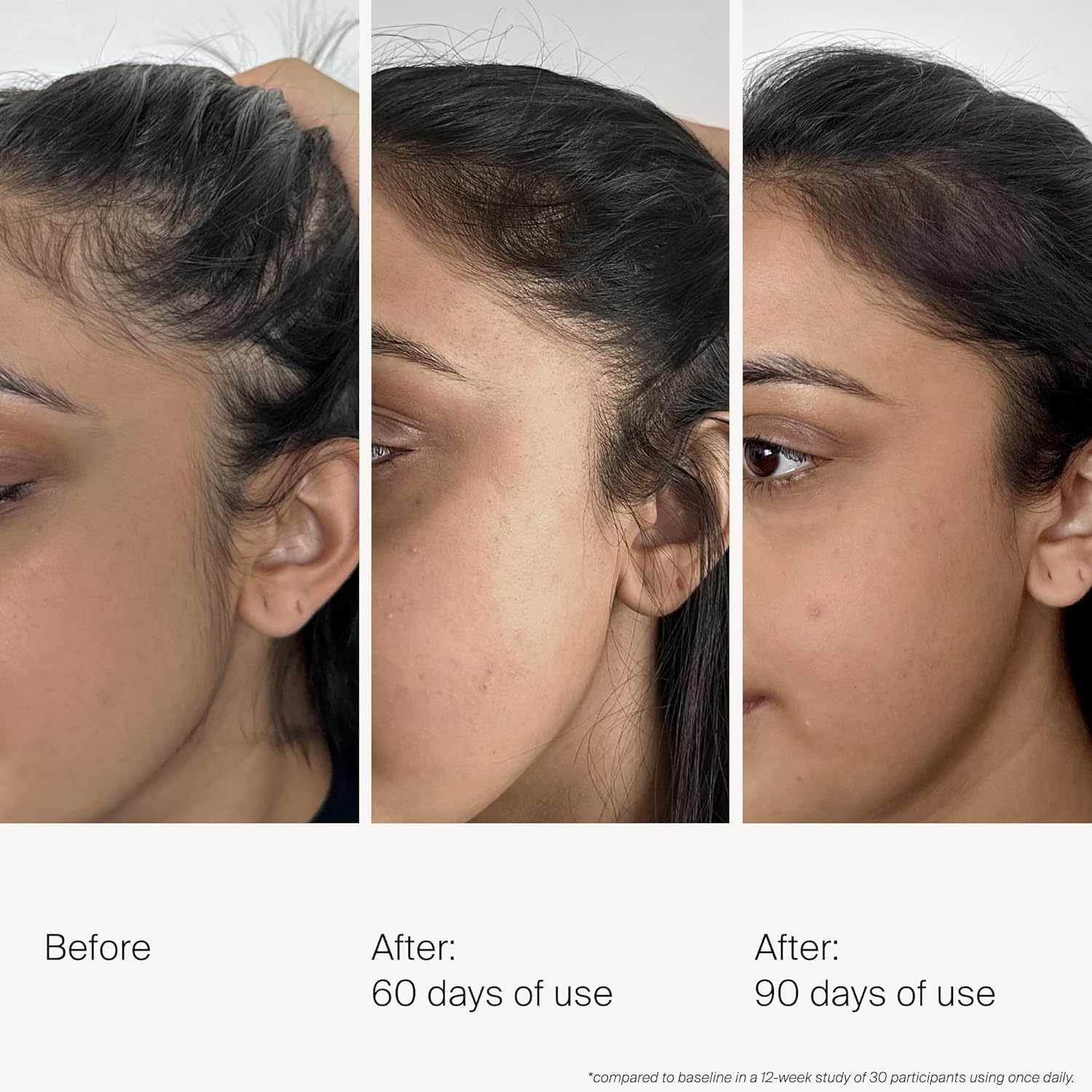 Living Proof Scalp Care Density Serum | Minimize Grey Hair, Boost Density