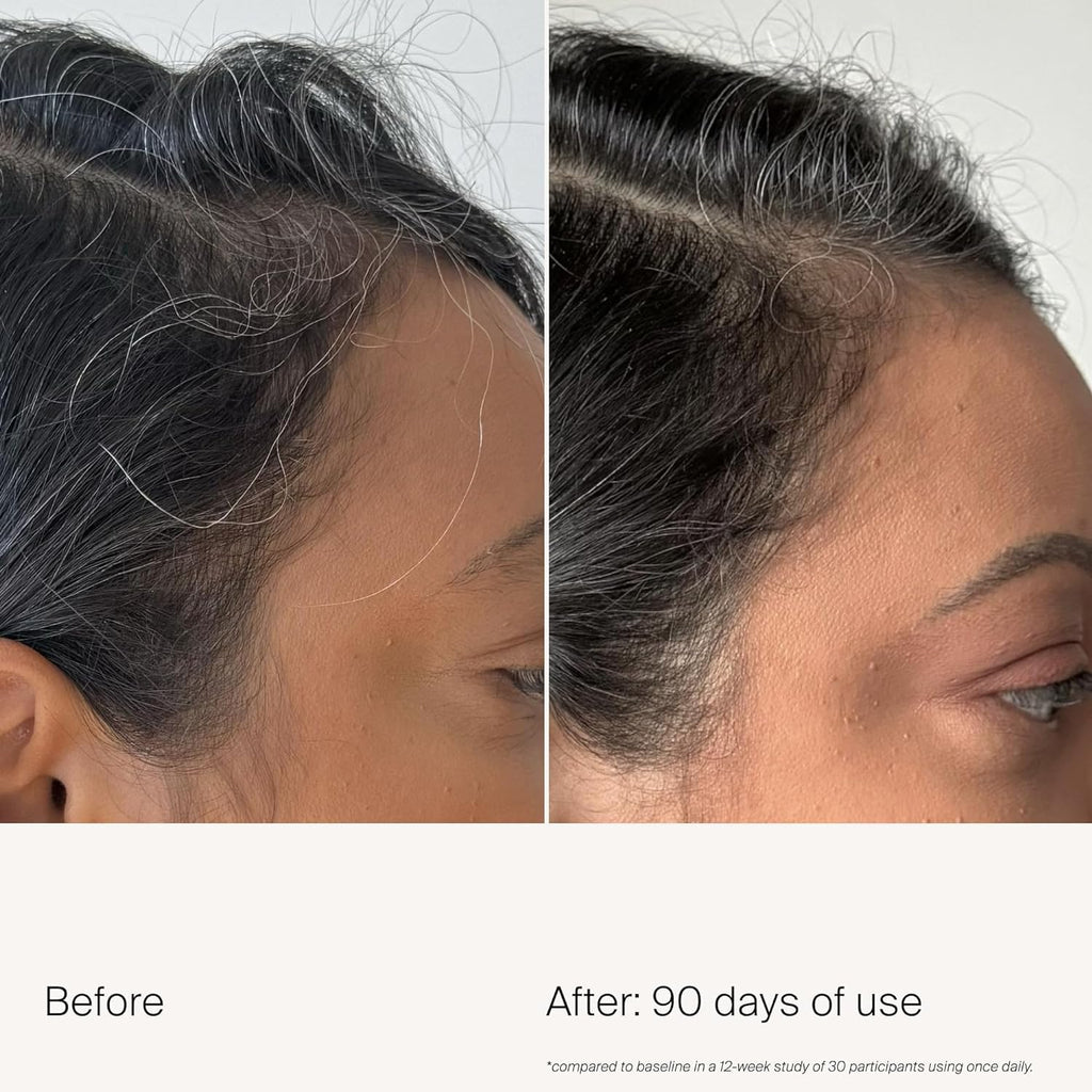 Living Proof Scalp Care Density Serum | Minimize Grey Hair, Boost Density