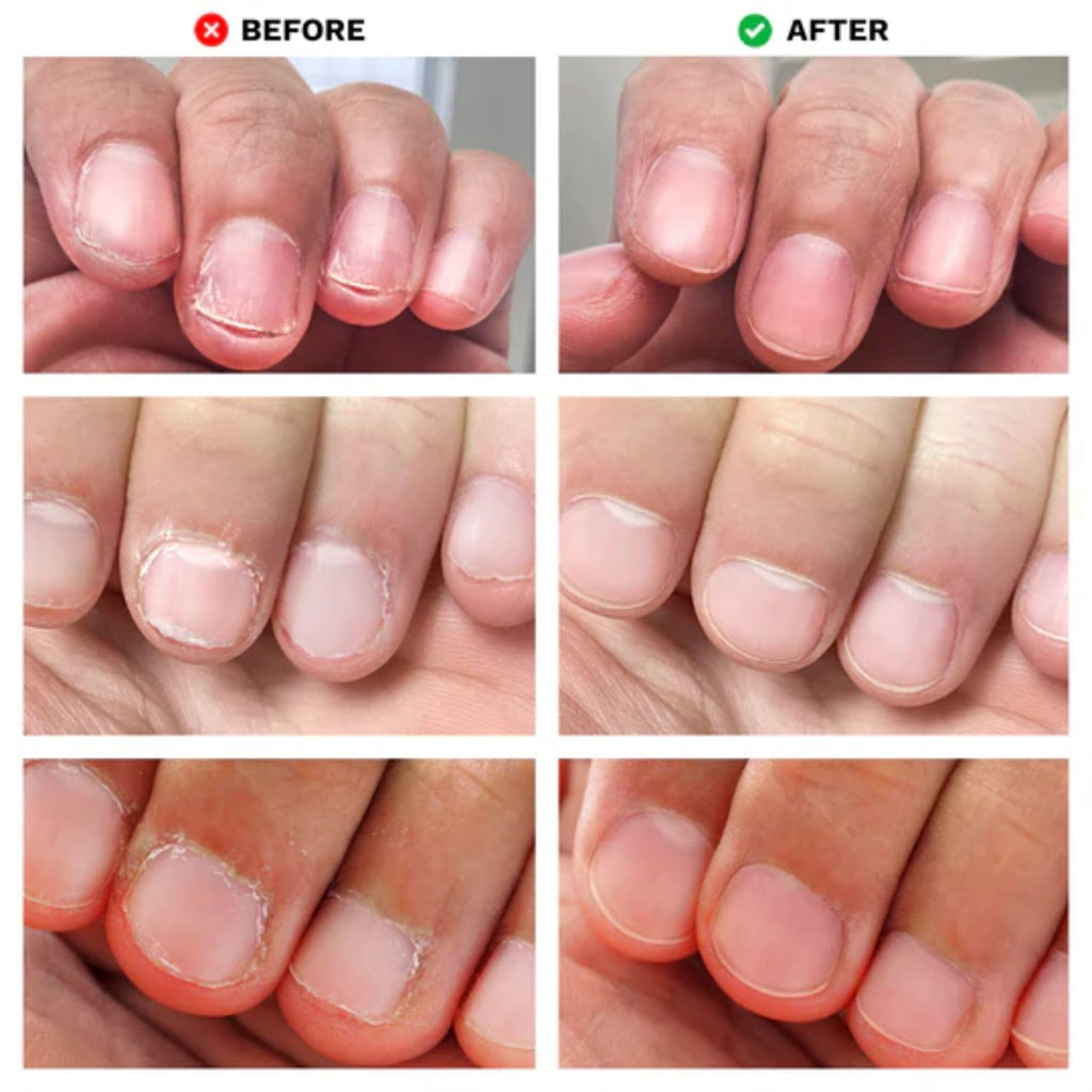 LONDONTOWN No Bite Nail Recovery – Bitter Deterrent Polish for Nail Biting Prevention