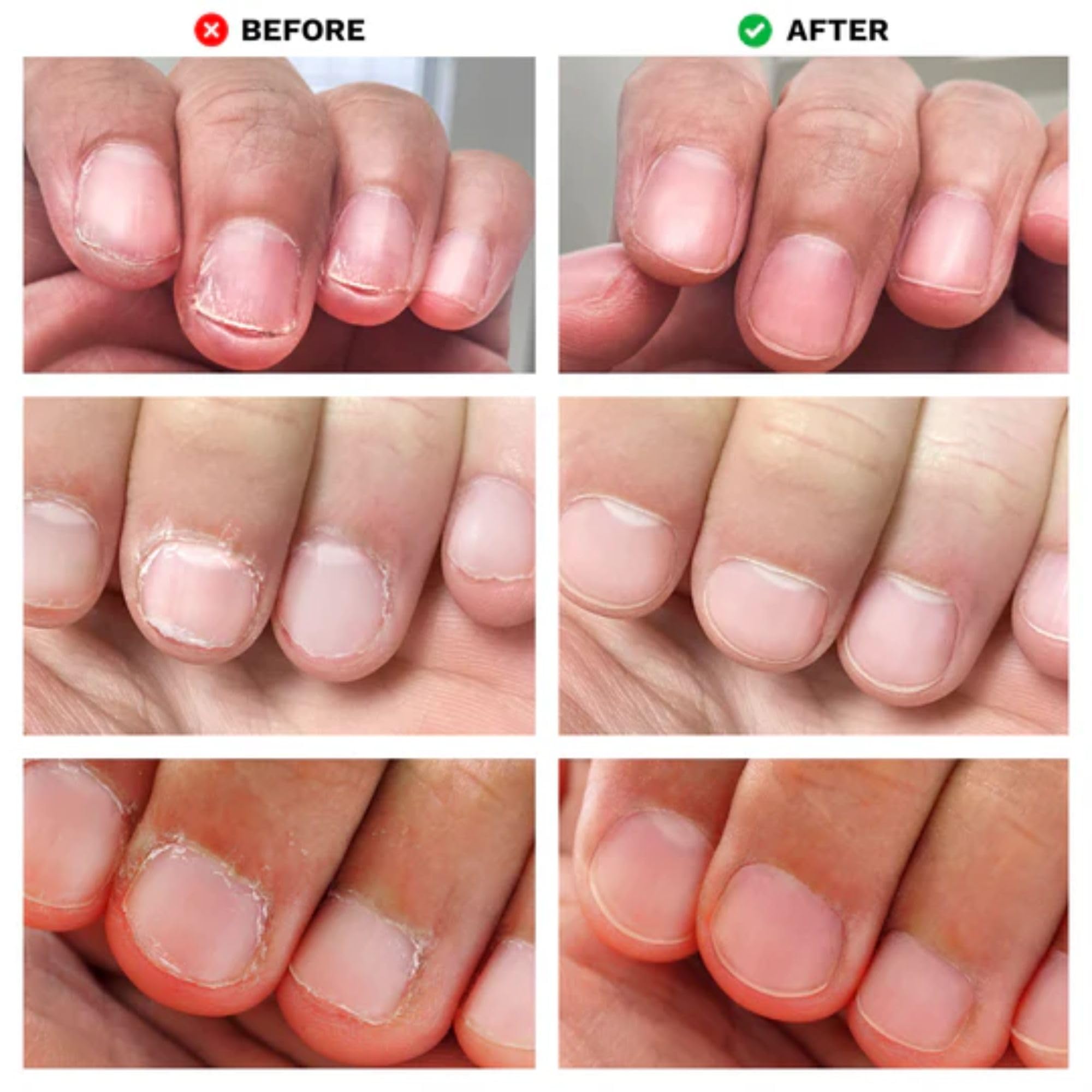 LONDONTOWN No Bite Nail Recovery – Bitter Deterrent Polish for Nail Biting Prevention