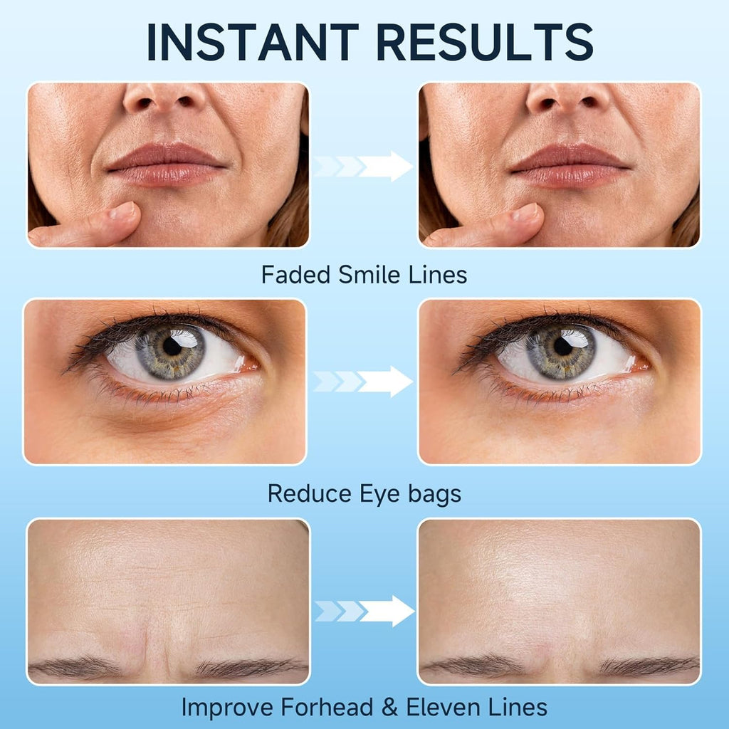 Loreviya Under Eye Cream – Retinol Eye Treatment for Dark Circles & Puffiness, 15ml